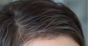 grey hair problems